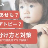 あせもアトピー見分け方ブログトップ