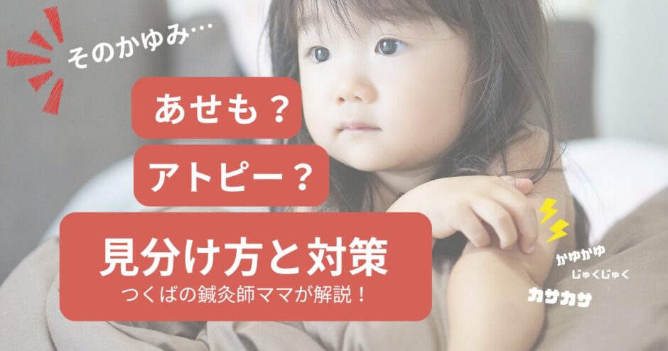 あせもアトピー見分け方ブログトップ